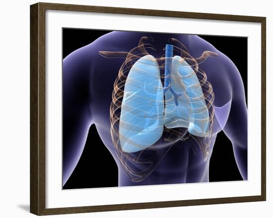 Conceptual Image of Human Lungs and Rib Cage-null-Framed Art Print