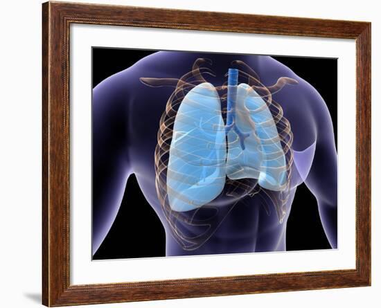 Conceptual Image of Human Lungs and Rib Cage-null-Framed Art Print