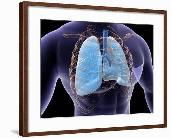 Conceptual Image of Human Lungs and Rib Cage-null-Framed Art Print