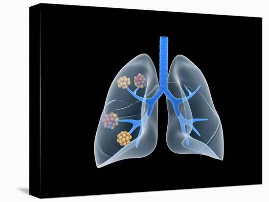 Stretched Canvas Print, , large