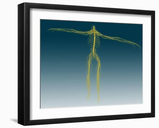 Conceptual Image of Human Nervous System-null-Framed Art Print