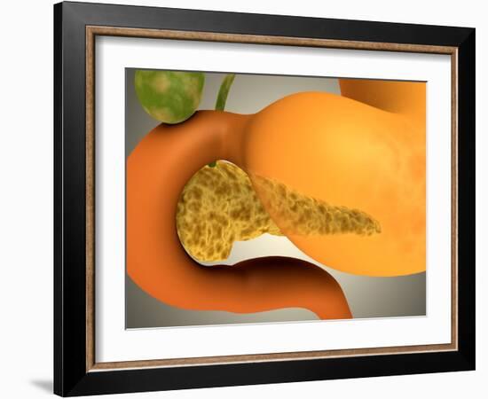 Conceptual Image of Human Pancreas and Stomach-null-Framed Art Print