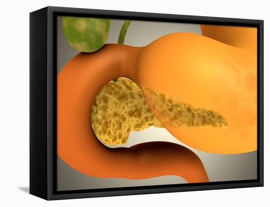 Conceptual Image of Human Pancreas and Stomach-null-Framed Stretched Canvas