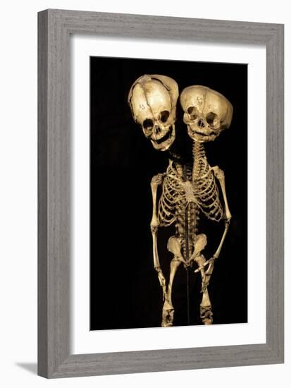 Conjoined Twins-Arno Massee-Framed Photographic Print