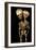 Conjoined Twins-Arno Massee-Framed Photographic Print