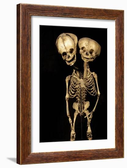 Conjoined Twins-Arno Massee-Framed Photographic Print