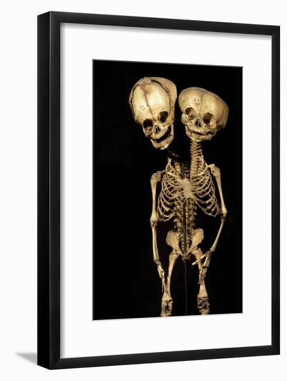 Conjoined Twins-Arno Massee-Framed Photographic Print