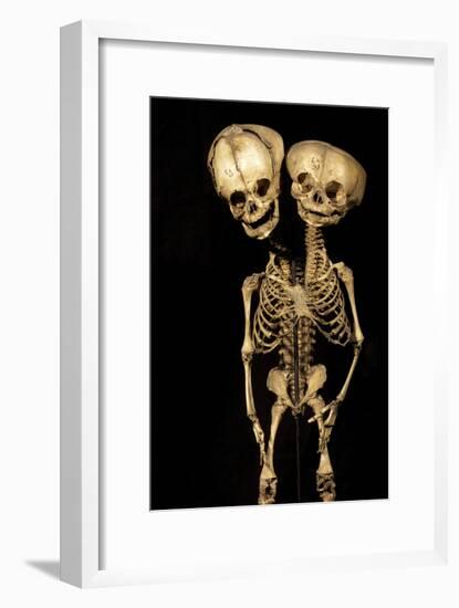 Conjoined Twins-Arno Massee-Framed Photographic Print