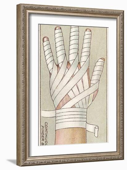 Continuous Finger Bandage, No.48 from the 'First Aid' Series of 'Wills's Cigarettes' Cards, 1913-English School-Framed Giclee Print