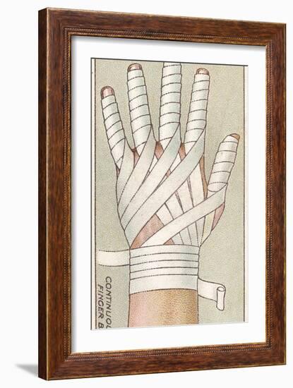 Continuous Finger Bandage, No.48 from the 'First Aid' Series of 'Wills's Cigarettes' Cards, 1913-English School-Framed Giclee Print