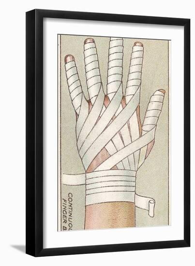 Continuous Finger Bandage, No.48 from the 'First Aid' Series of 'Wills's Cigarettes' Cards, 1913-English School-Framed Giclee Print