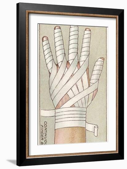 Continuous Finger Bandage, No.48 from the 'First Aid' Series of 'Wills's Cigarettes' Cards, 1913-English School-Framed Giclee Print