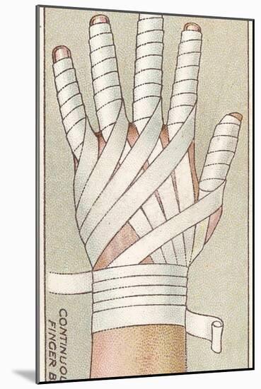 Continuous Finger Bandage, No.48 from the 'First Aid' Series of 'Wills's Cigarettes' Cards, 1913-English School-Mounted Giclee Print