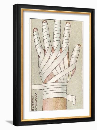 Continuous Finger Bandage, No.48 from the 'First Aid' Series of 'Wills's Cigarettes' Cards, 1913-English School-Framed Giclee Print