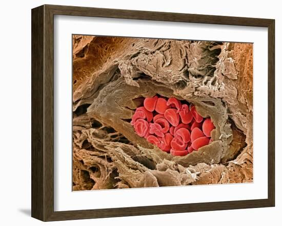 Coronary Artery, SEM-Steve Gschmeissner-Framed Photographic Print