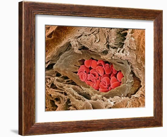 Coronary Artery, SEM-Steve Gschmeissner-Framed Photographic Print