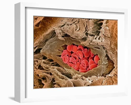 Coronary Artery, SEM-Steve Gschmeissner-Framed Photographic Print