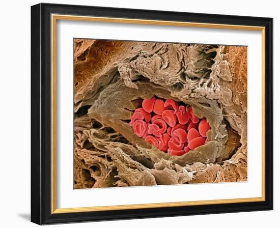 Coronary Artery, SEM-Steve Gschmeissner-Framed Photographic Print