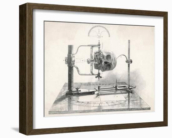 Cranionmeter Holds a Skull in Place-null-Framed Art Print