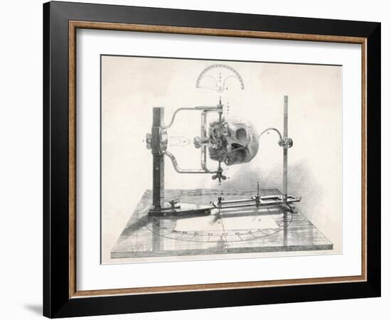 Cranionmeter Holds a Skull in Place-null-Framed Art Print