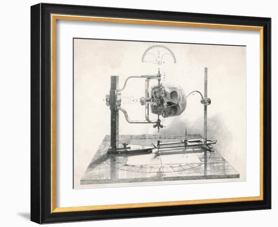 Cranionmeter Holds a Skull in Place-null-Framed Art Print