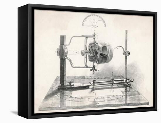 Cranionmeter Holds a Skull in Place-null-Framed Stretched Canvas