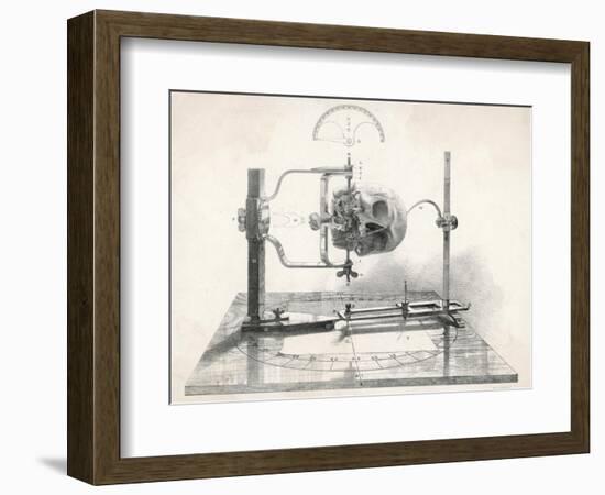 Cranionmeter Holds a Skull in Place--Framed Art Print