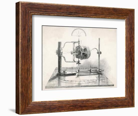 Cranionmeter Holds a Skull in Place--Framed Art Print