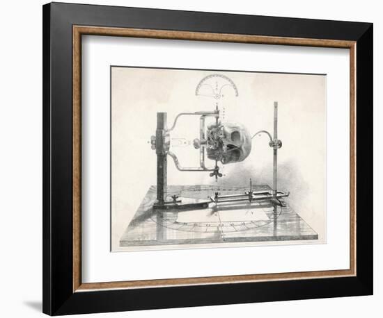 Cranionmeter Holds a Skull in Place-null-Framed Art Print