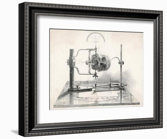 Cranionmeter Holds a Skull in Place-null-Framed Art Print