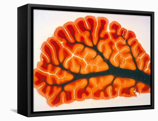 Cross-section of Cortex & Medulla of Cerebellum-Volker Steger-Framed Premier Image Canvas