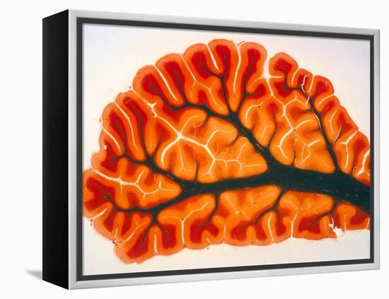 Cross-section of Cortex & Medulla of Cerebellum-Volker Steger-Framed Premier Image Canvas