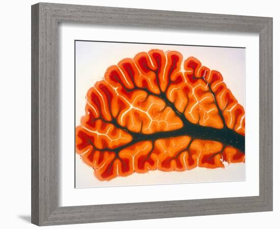 Cross-section of Cortex & Medulla of Cerebellum-Volker Steger-Framed Photographic Print