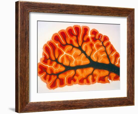 Cross-section of Cortex & Medulla of Cerebellum-Volker Steger-Framed Photographic Print