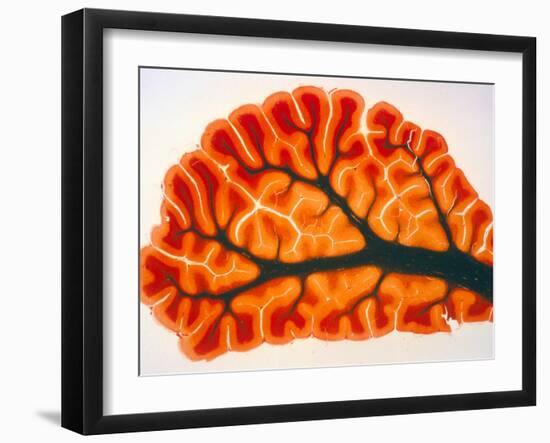 Cross-section of Cortex & Medulla of Cerebellum-Volker Steger-Framed Photographic Print