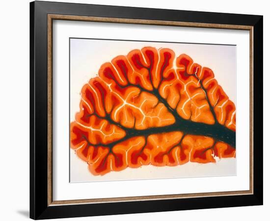 Cross-section of Cortex & Medulla of Cerebellum-Volker Steger-Framed Photographic Print
