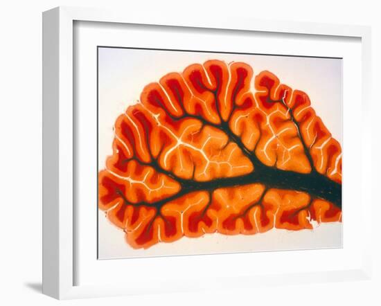 Cross-section of Cortex & Medulla of Cerebellum-Volker Steger-Framed Photographic Print