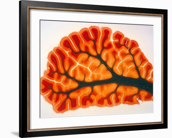 Cross-section of Cortex & Medulla of Cerebellum-Volker Steger-Framed Photographic Print