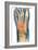 Crushed Broken Foot, X-ray-Science Photo Library-Framed Photographic Print