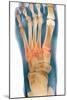 Crushed Broken Foot, X-ray-Science Photo Library-Mounted Photographic Print