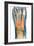 Crushed Broken Foot, X-ray-Science Photo Library-Framed Photographic Print