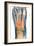 Crushed Broken Foot, X-ray-Science Photo Library-Framed Photographic Print