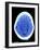 CT Brain Scan of Dementia-Science Photo Library-Framed Photographic Print