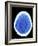 CT Brain Scan of Dementia-Science Photo Library-Framed Photographic Print