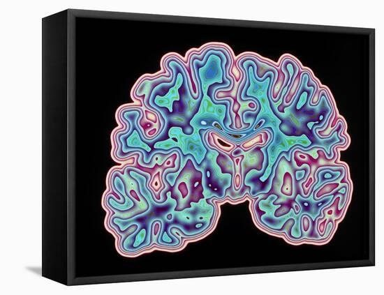 CT Scan of Brain-PASIEKA-Framed Premier Image Canvas