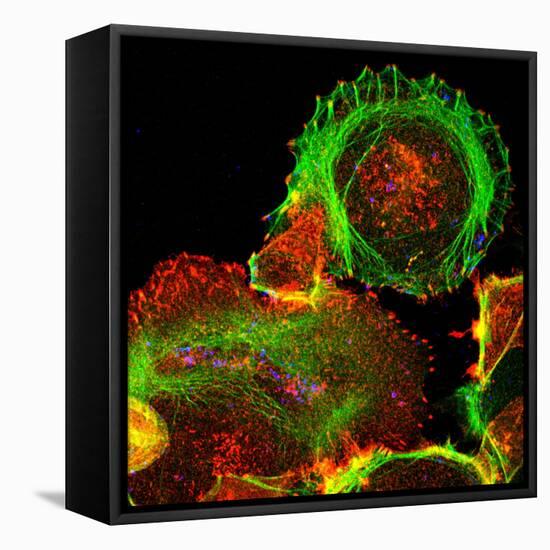 Cultured Cell, Light Micrograph-Science Photo Library-Framed Premier Image Canvas
