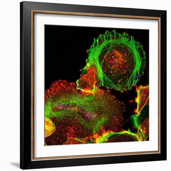 Cultured Cell, Light Micrograph-Science Photo Library-Framed Premium Photographic Print