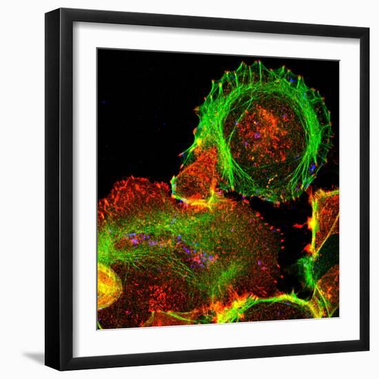 Cultured Cell, Light Micrograph-Science Photo Library-Framed Premium Photographic Print