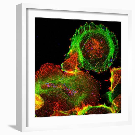 Cultured Cell, Light Micrograph-Science Photo Library-Framed Premium Photographic Print