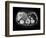 Cystic Pancreas Tumour, CT Scan-ZEPHYR-Framed Photographic Print